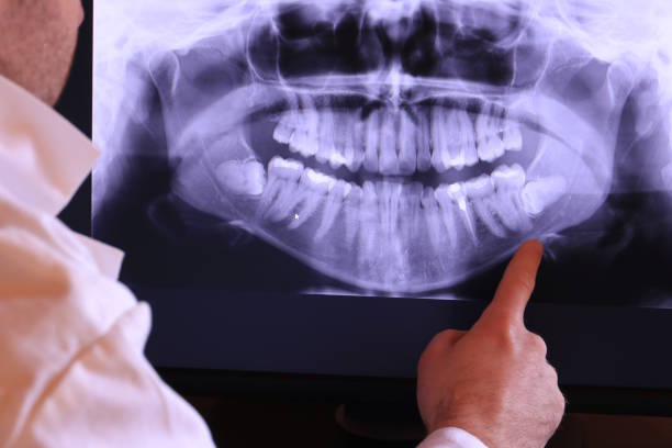 Best Knocked-Out Tooth Emergency  in Royal Oak, MI